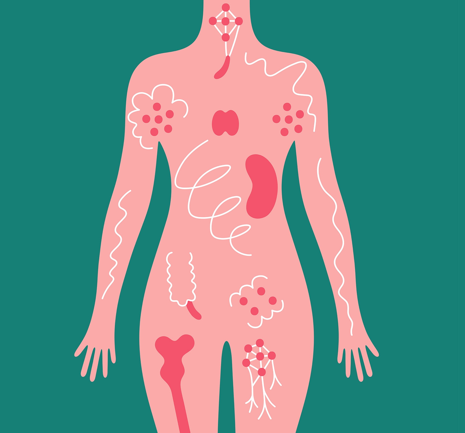 Her Various Symptoms Seemed Unrelated Then One Doctor Put It All Together The New York Times